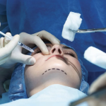 TikToks, bisturí y playa: el auge de las cirugías estéticas en México